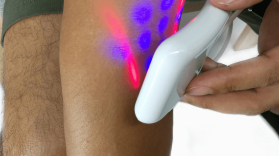Inovativna naprava Akupunkturna laserska ura